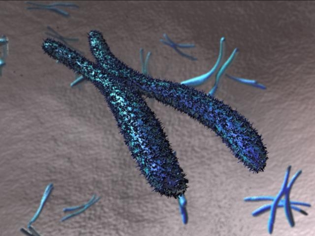 Chromosome